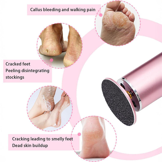 Replaceable Sandpaper Discs (60 PCS)