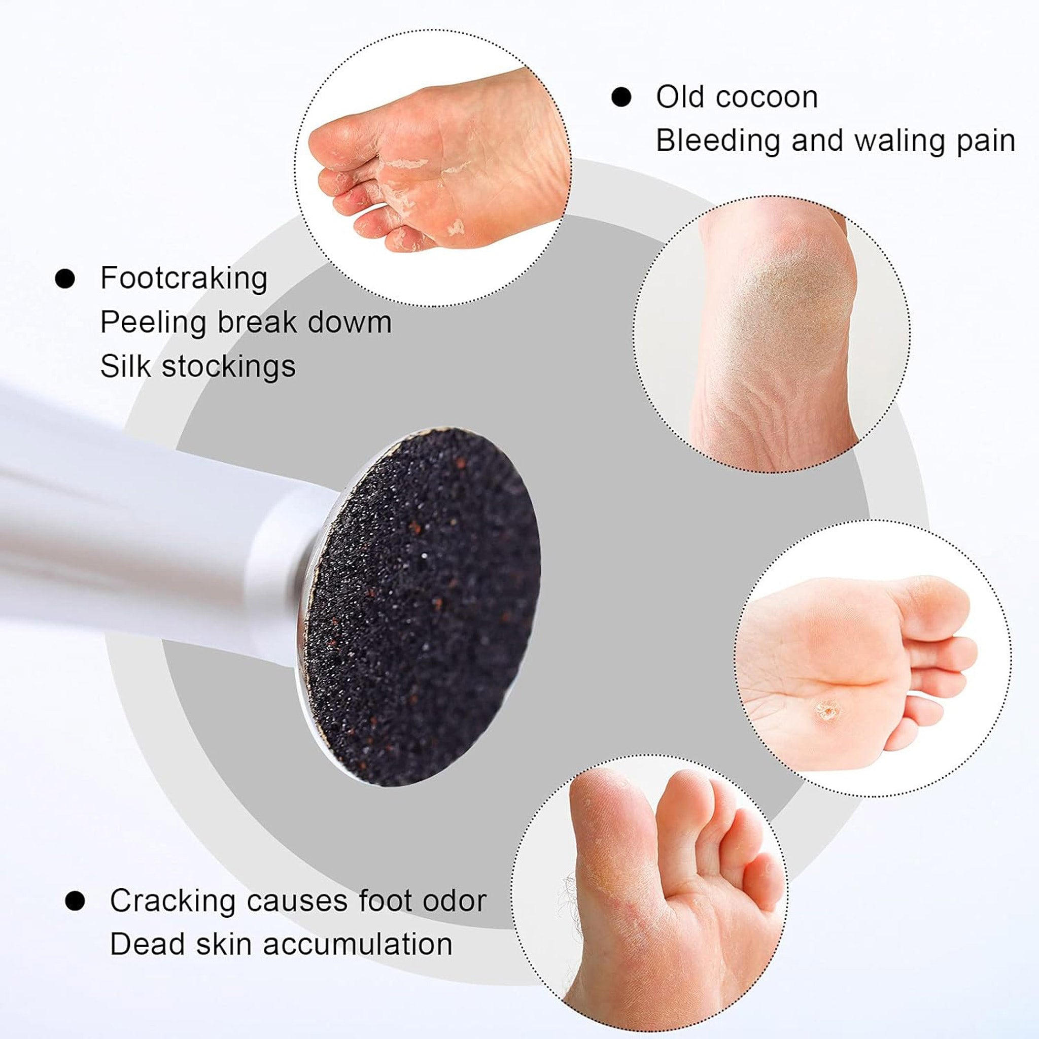 100 PCS Replacement Sandpaper Discs Callus Remover