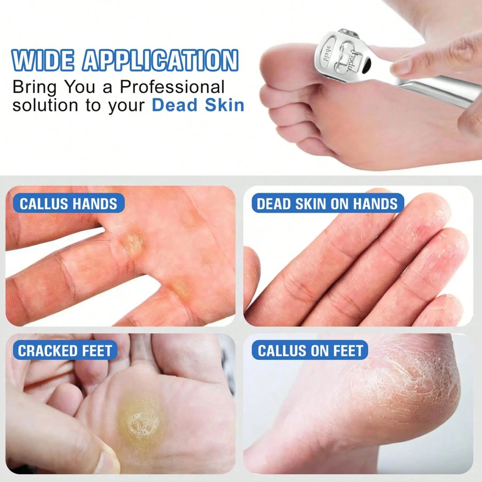 Stainless Steel Callus Shaver with Replaceable Blade